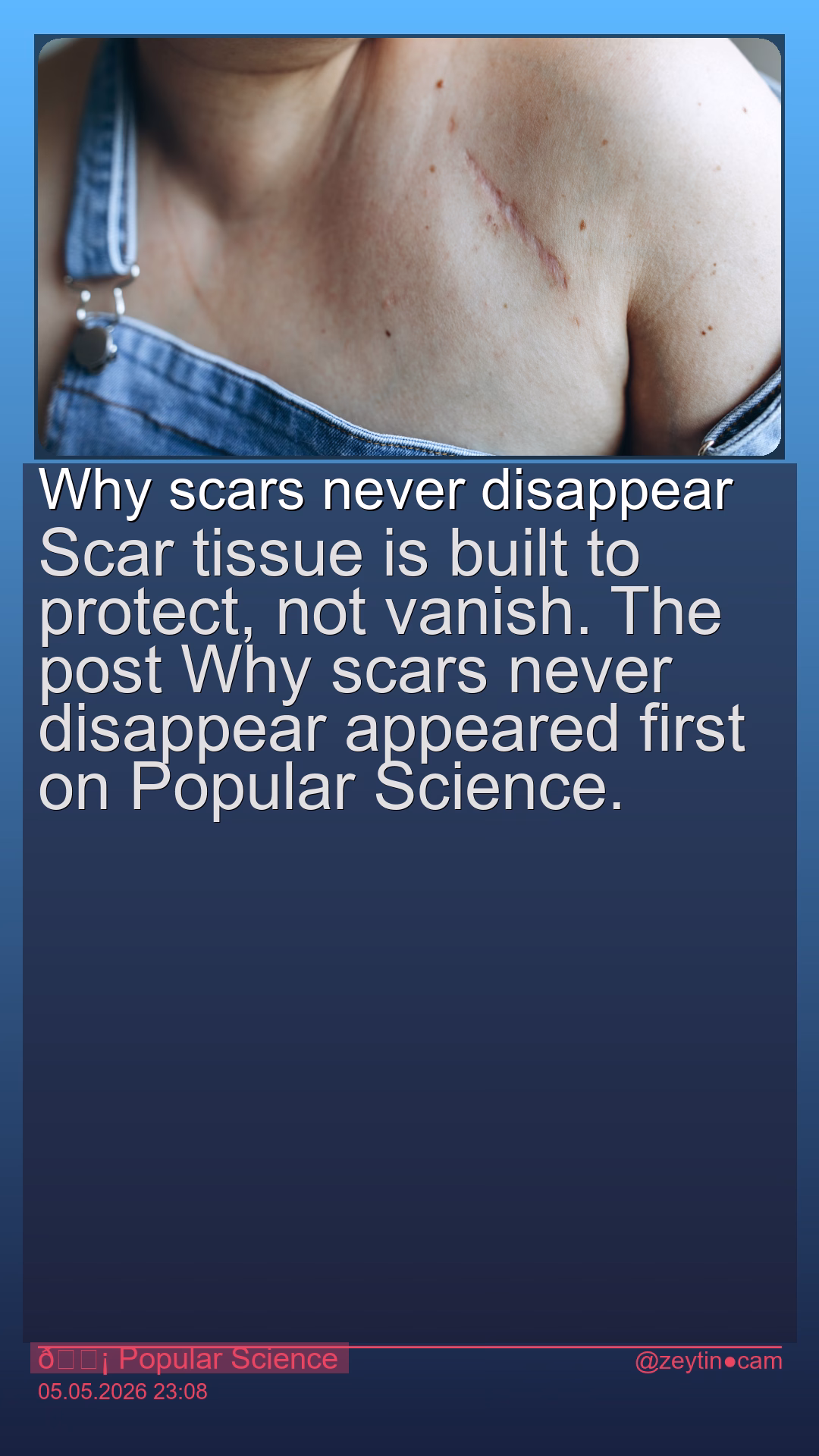 Why scars never disappear